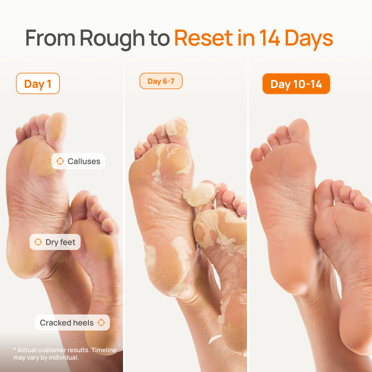 Peach Foot Peeling Mask - Plantifique