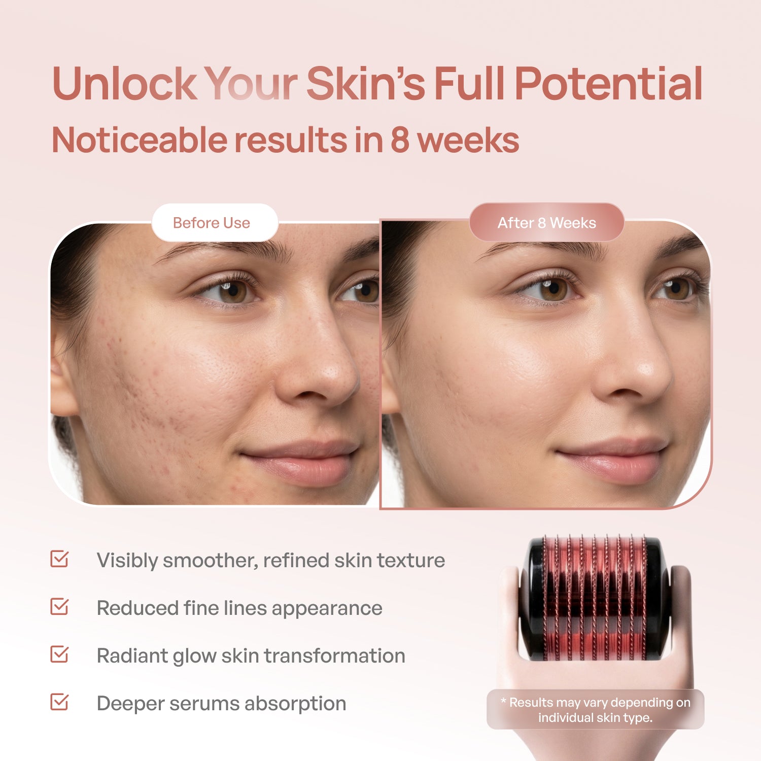 Derma Roller for Hair & Skin - Plantifique