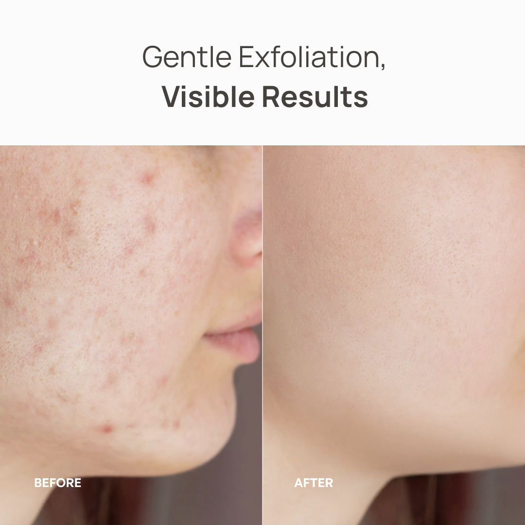 Kojic Acid & Turmeric Cleansing Pads - Plantifique