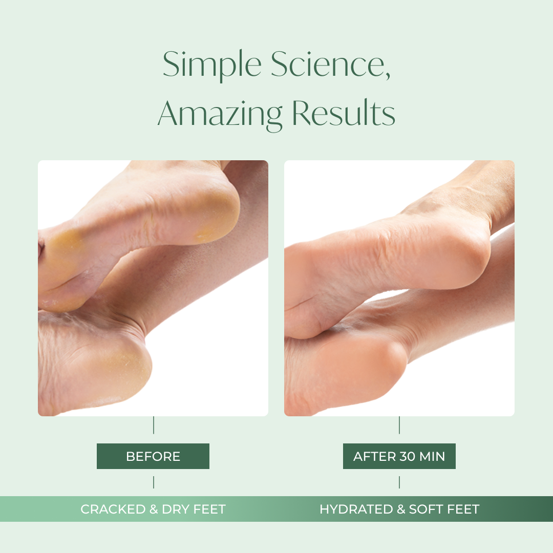 Results after using the Plantifique Foot Hydrating Mask