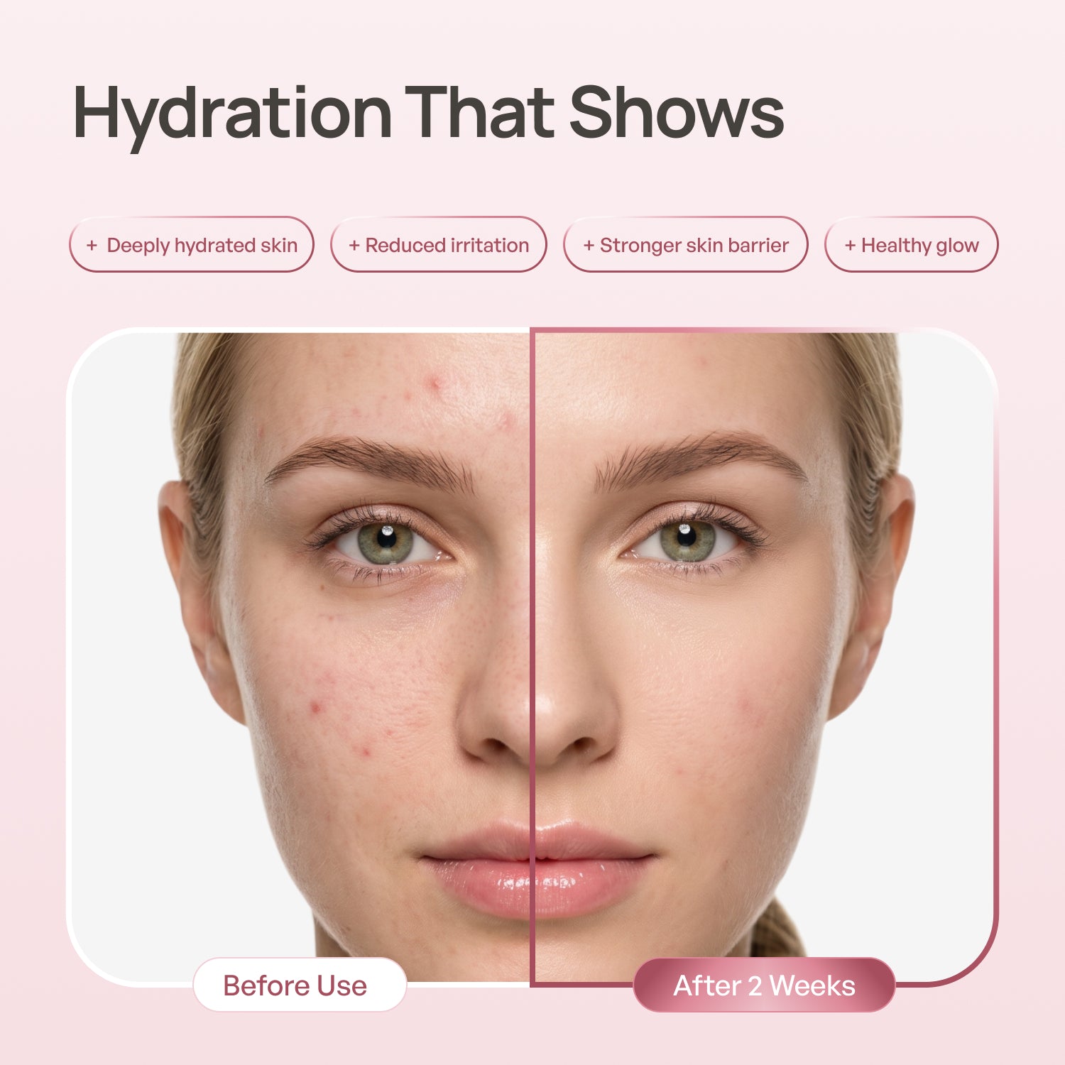 PDRN Milky Rice Toner - Plantifique