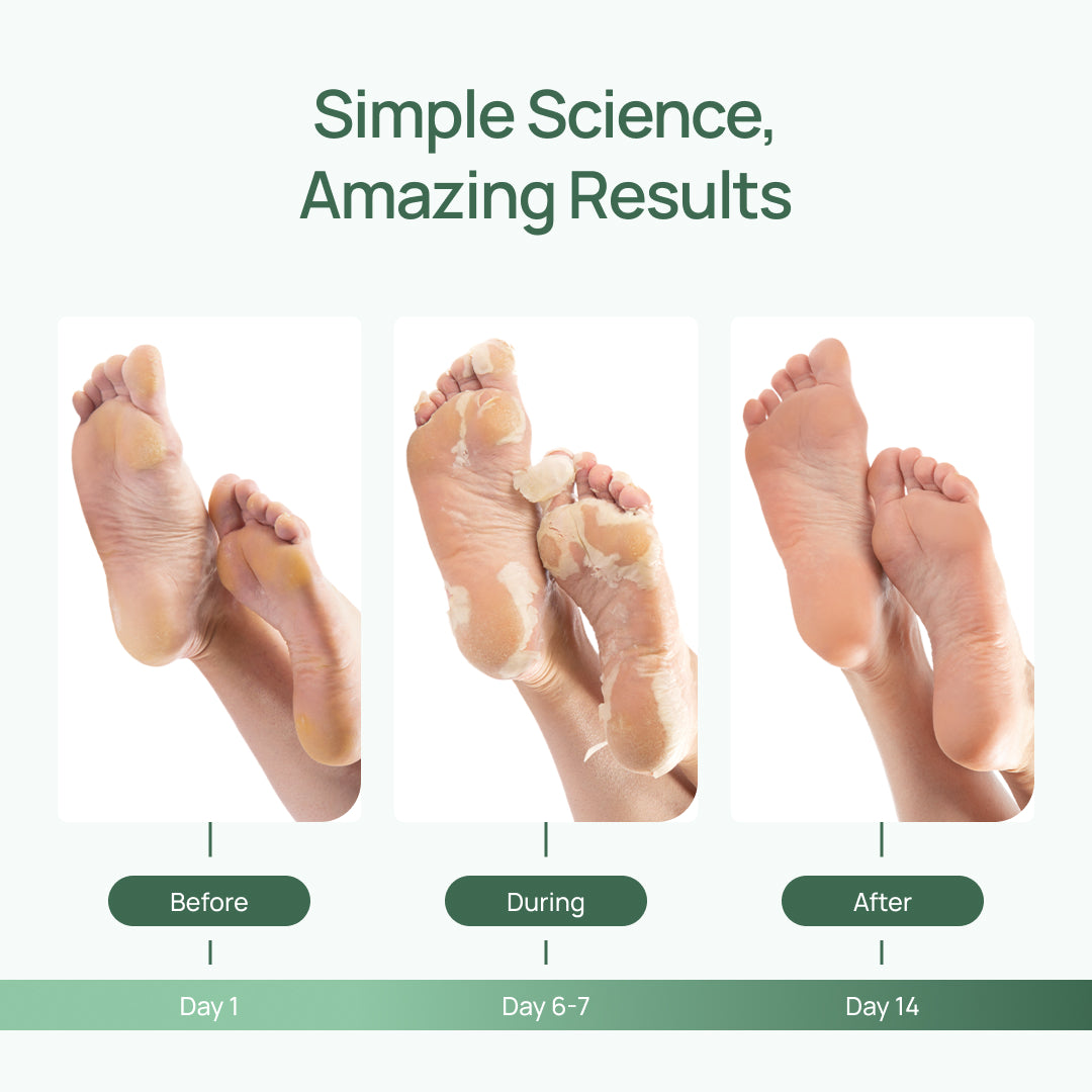 Foot Peeling Mask - Plantifique
