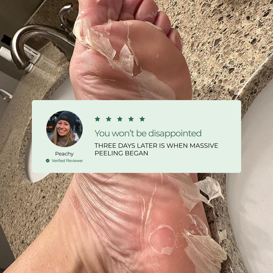 Customer Results with the Plantifique Foot Peel Mask