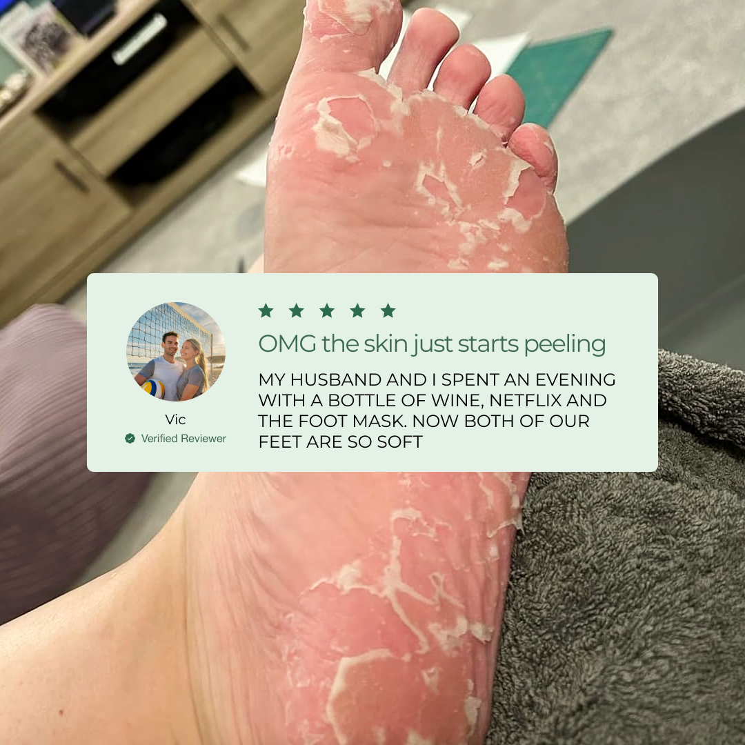 Customer Results with the Plantifique Foot Peel Mask