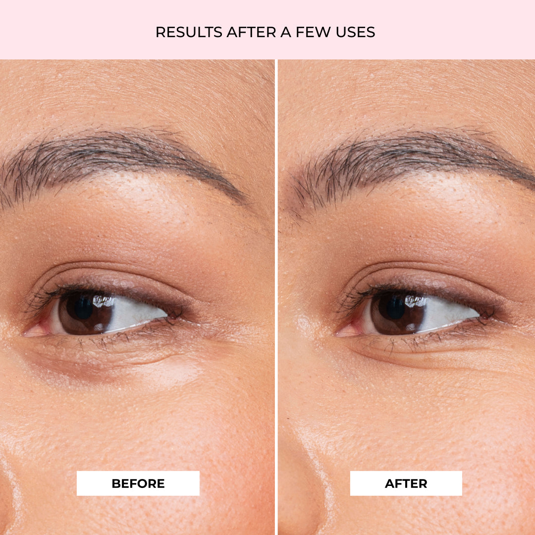 Superfood Under Eye Gel Patches - Plantifique