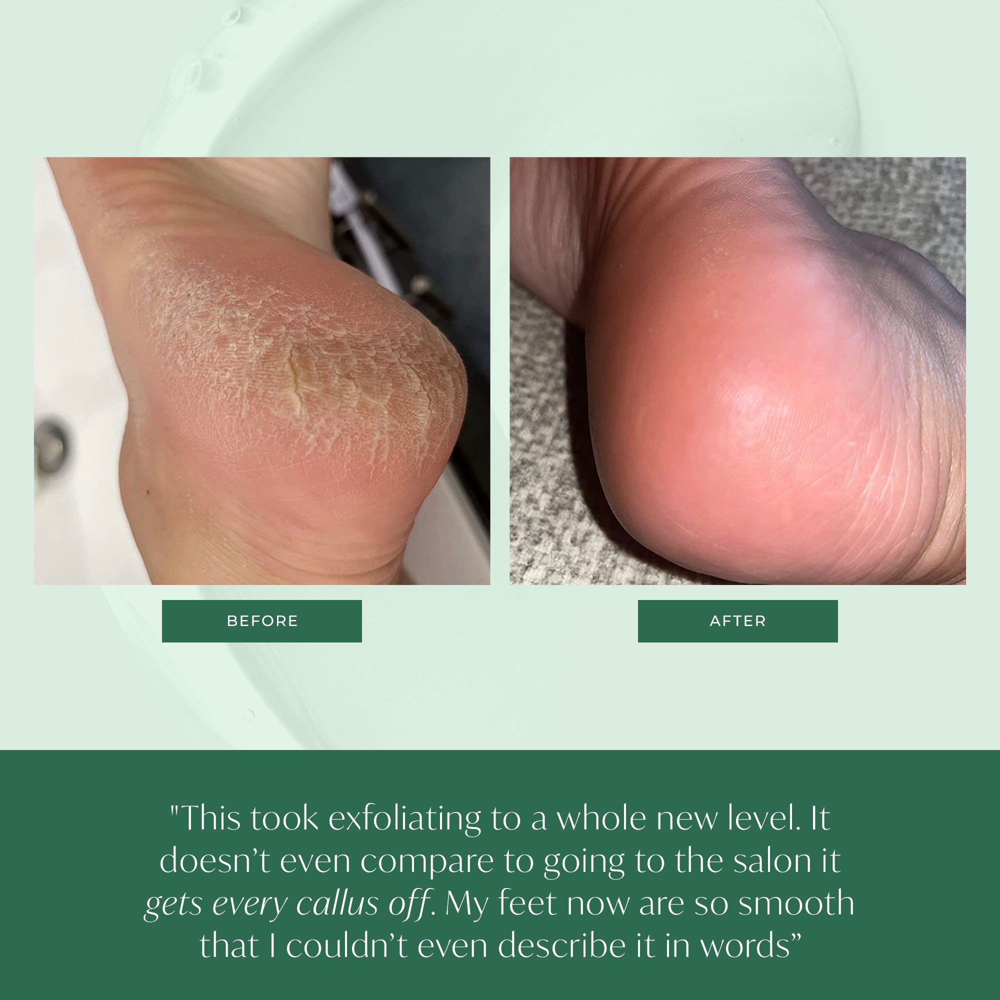 Callus Remover - Plantifique