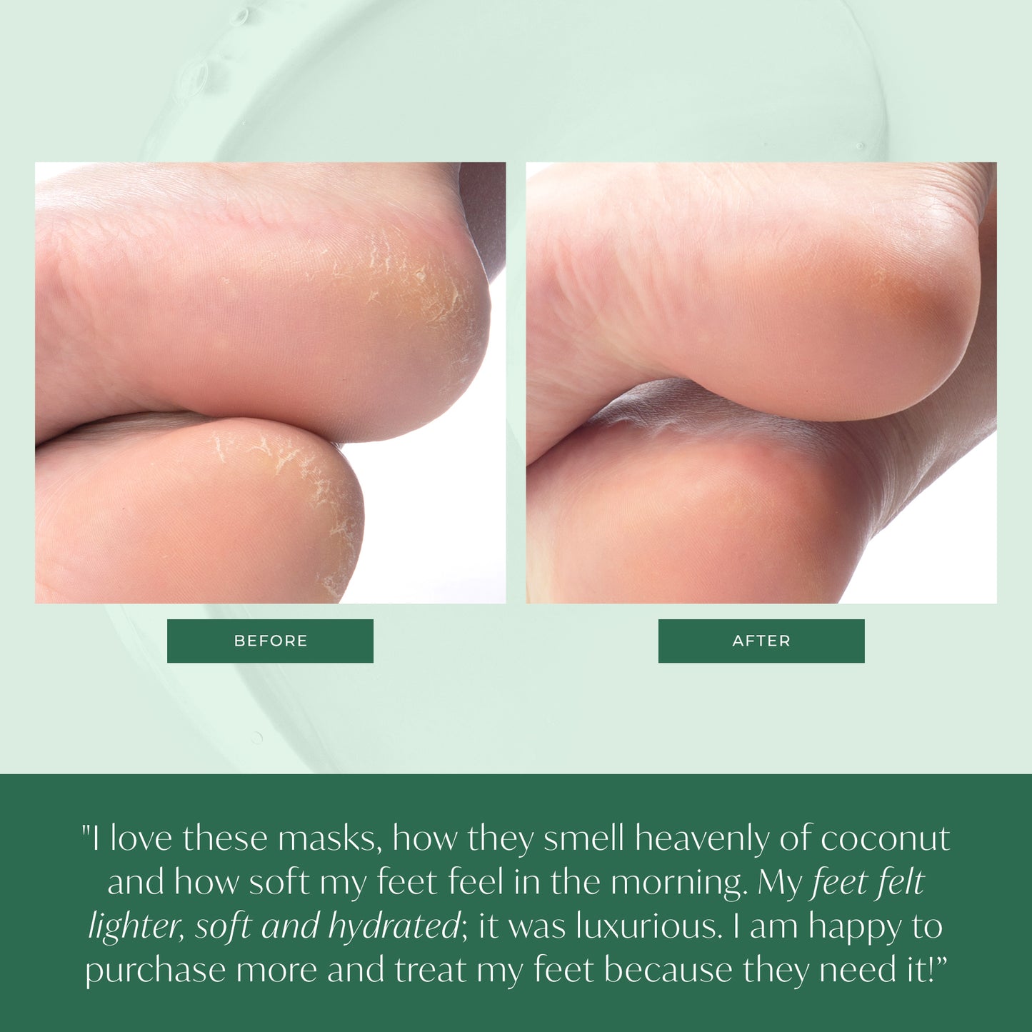 Baby Soft Feet Combo - Plantifique