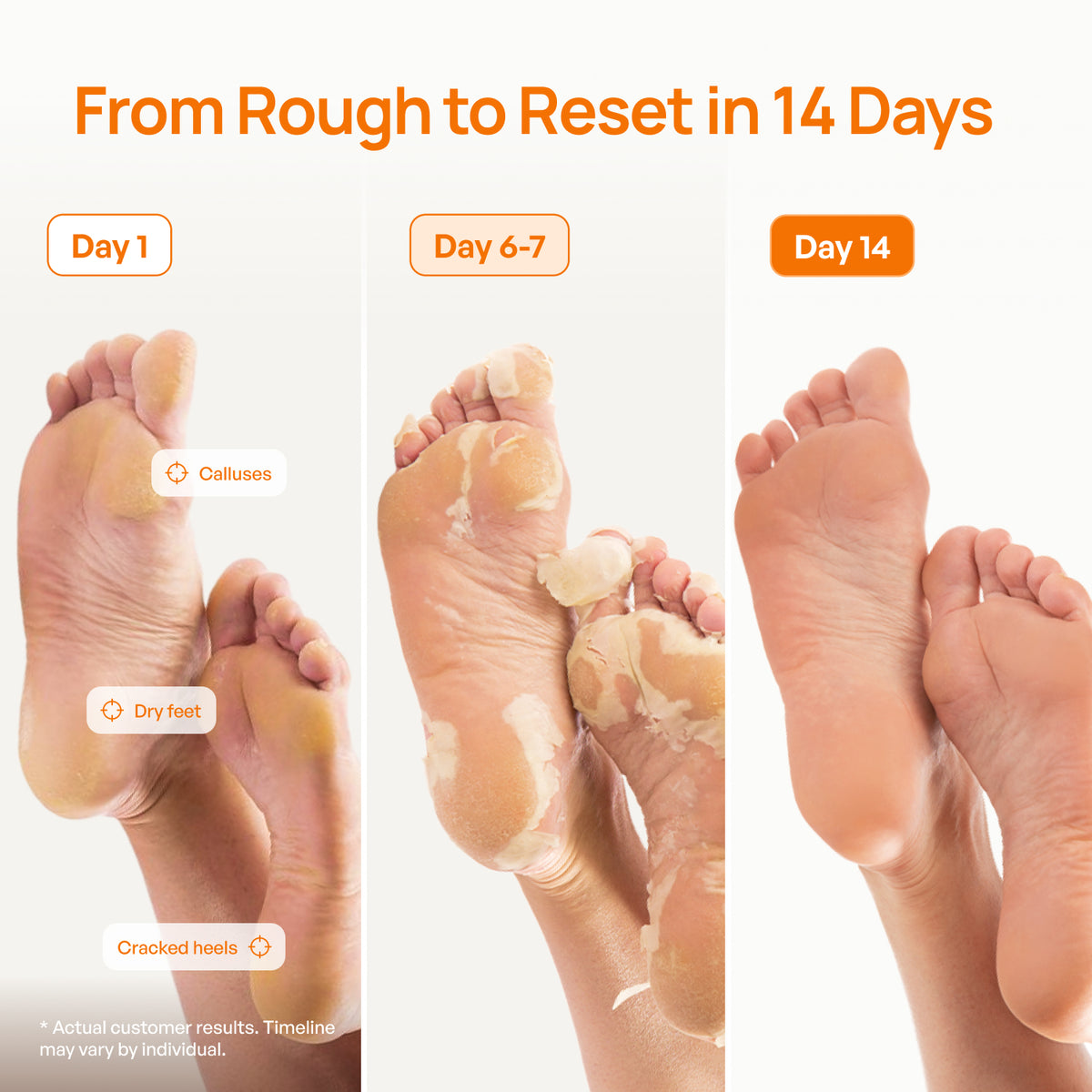 Peach Foot Peeling Mask