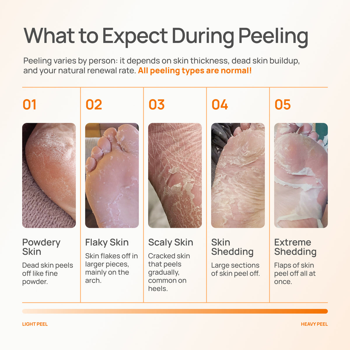 Peach Foot Peeling Mask - Plantifique 