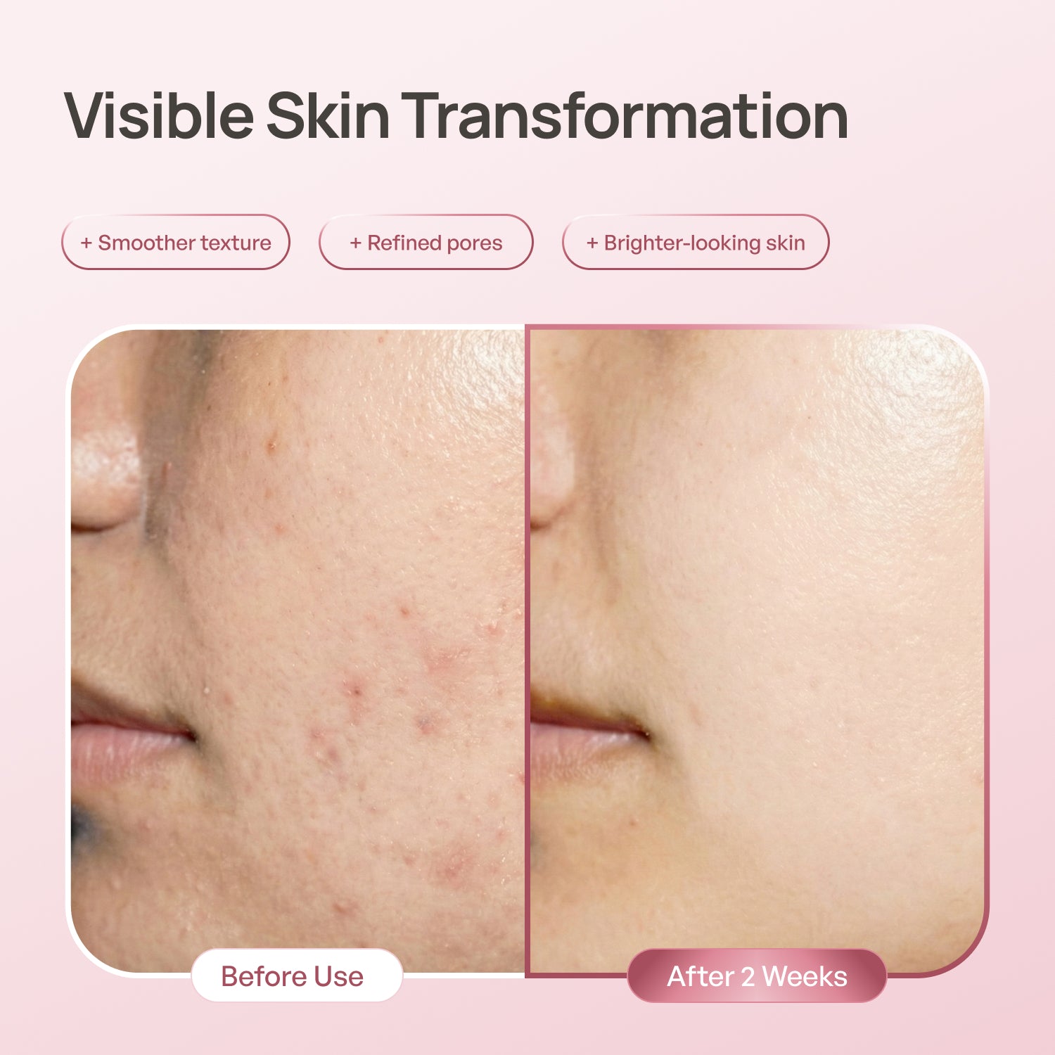 PDRN Niacinamide 10% Face Serum - Plantifique 