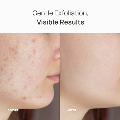 Kojic Acid & Turmeric Cleansing Pads - Plantifique 