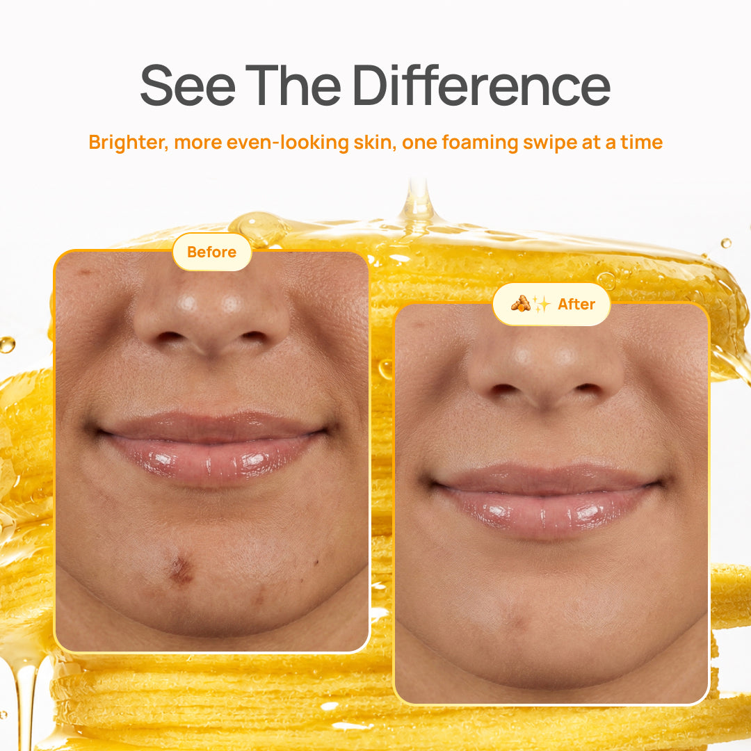 Kojic Acid & Turmeric Cleansing Pads - Plantifique 