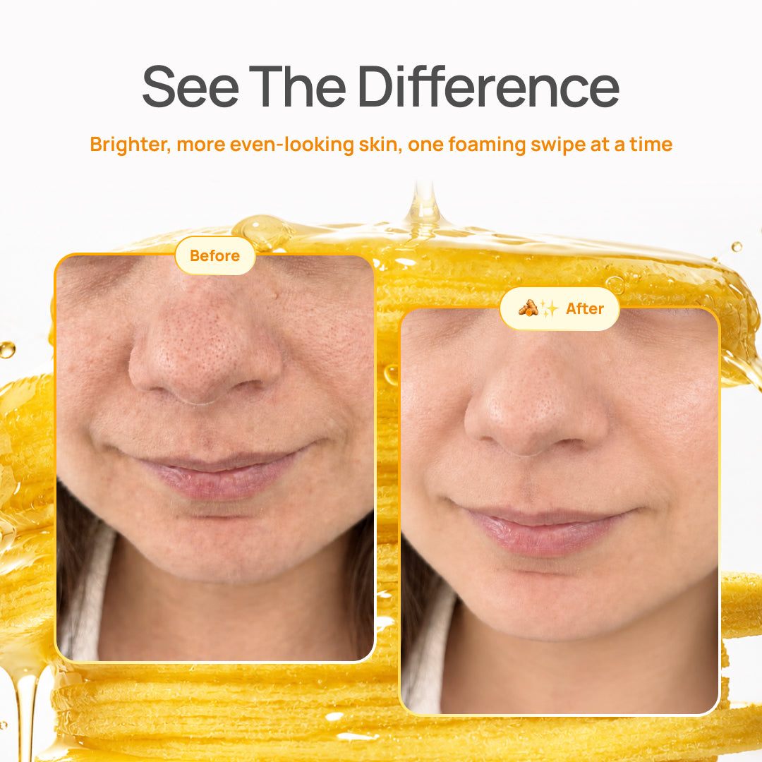 Kojic Acid & Turmeric Cleansing Pads - Plantifique 