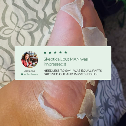 Customer Results with the Plantifique Foot Peel Mask