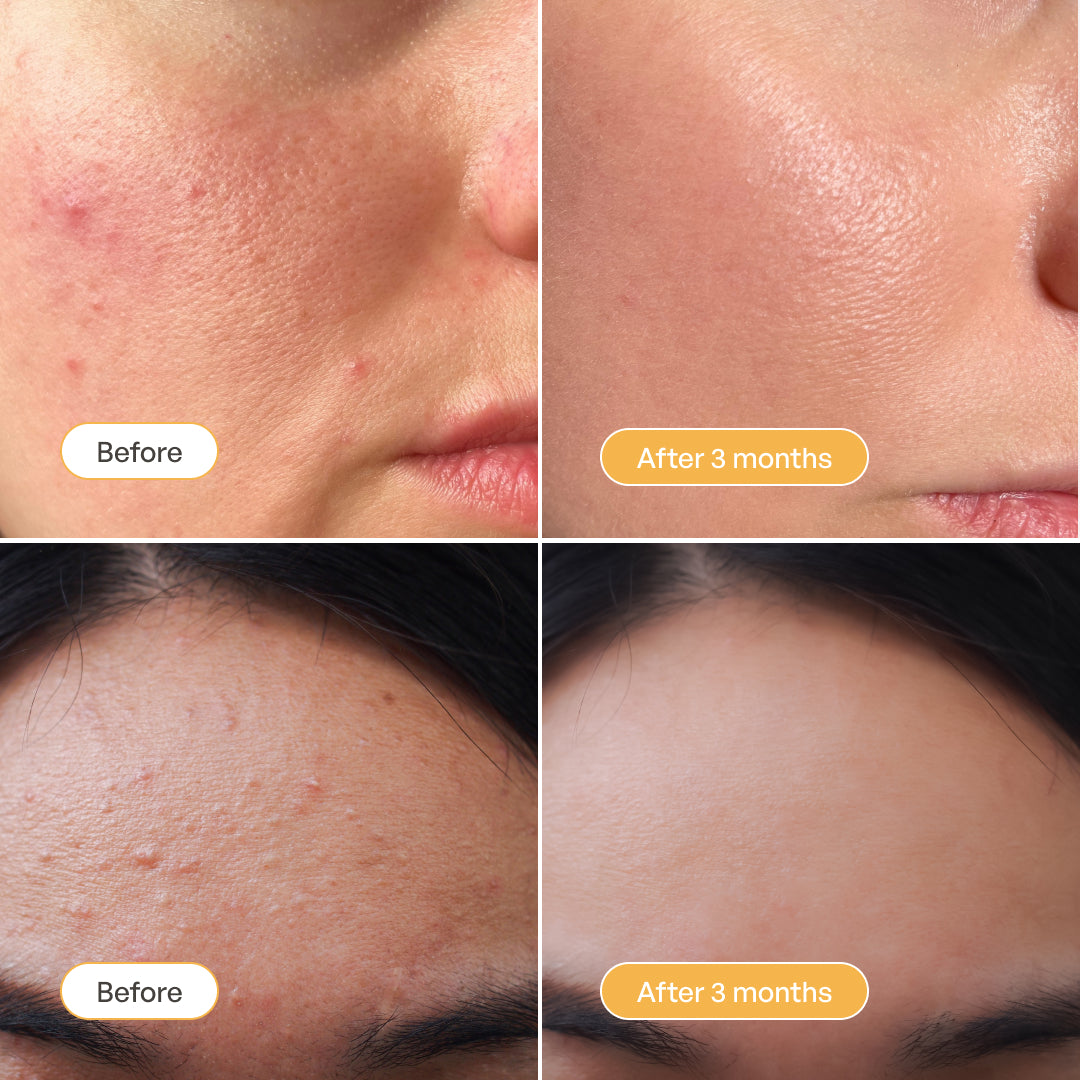 Turmeric Vitamin C Clay Mask - Plantifique 