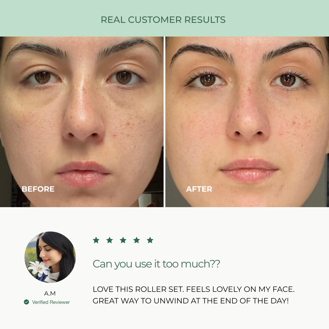 woman's before and after depuffed face after using the Plantifique massage set