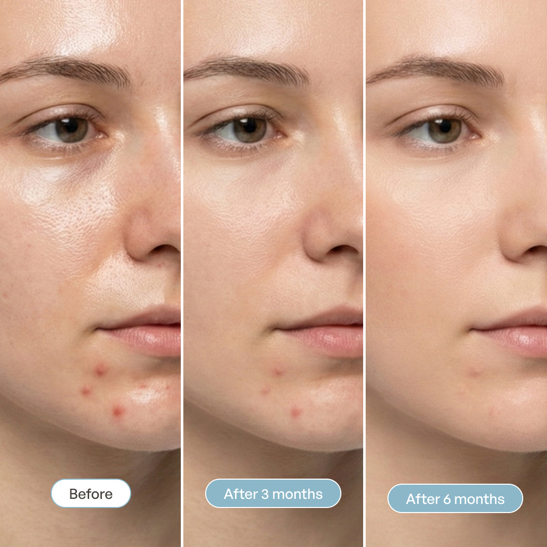 Volcano Mud Mask - Plantifique 