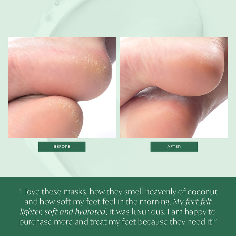 Soft Feet for Months